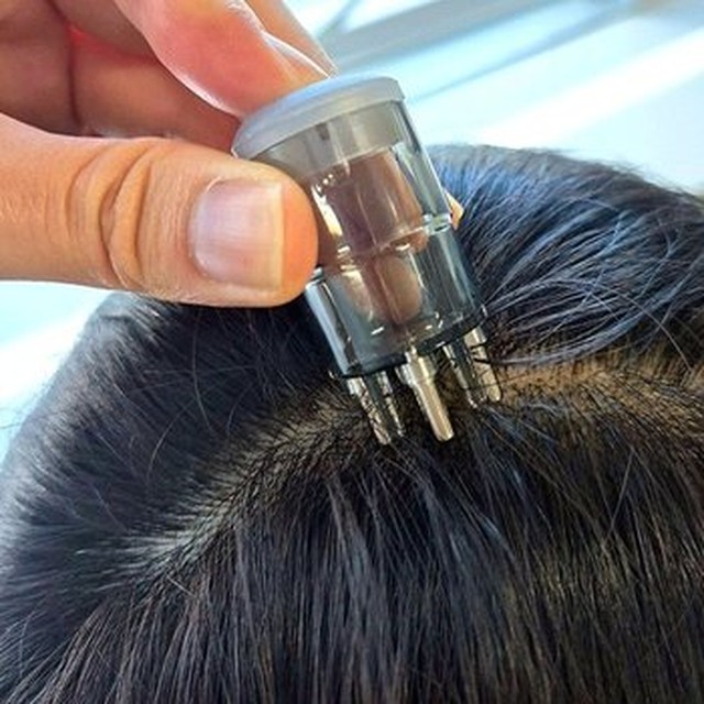 [기타] 5ml 미니 셀프 두피 관리용 앰플 도포 마사지기 미용실 두피팩 영양공급 에센스 투입[이마트몰]